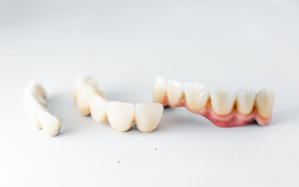 What types of problems do dental veneers fix?